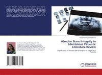 bokomslag Alveolar Bone Integrity in Edentulous Patients: Literature Review