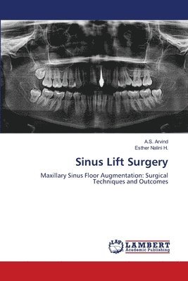 bokomslag Sinus Lift Surgery