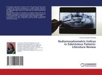 bokomslag Radiomorphometric Indices in Edentulous Patients: Literature Review