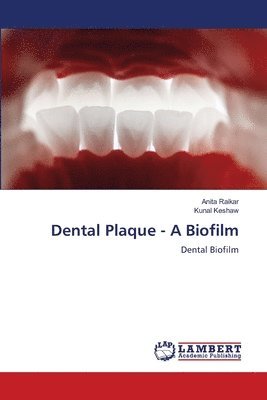 Dental Plaque - A Biofilm 1