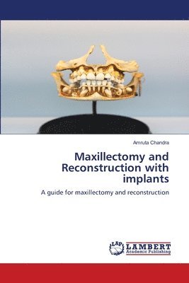 Maxillectomy and Reconstruction with implants 1