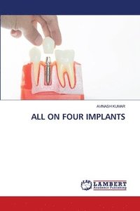 bokomslag All on Four Implants