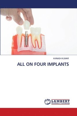 bokomslag All on Four Implants