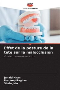 bokomslag Effet de la posture de la tête sur la malocclusion