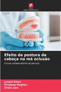 bokomslag Efeito da postura da cabeça na má oclusão