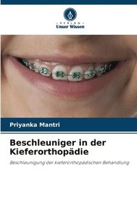 bokomslag Beschleuniger in der Kieferorthopdie