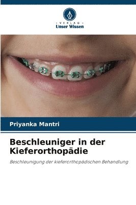 Beschleuniger in der Kieferorthopdie 1