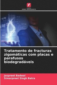 bokomslag Tratamento de fracturas zigomáticas com placas e parafusos biodegradáveis