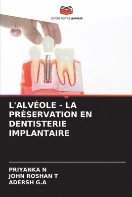 bokomslag L'Alvole - La Prservation En Dentisterie Implantaire