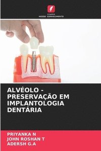 bokomslag Alvolo - Preservao Em Implantologia Dentria