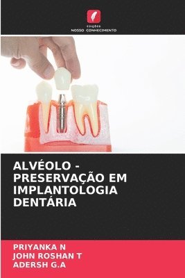 bokomslag Alvéolo - Preservação Em Implantologia Dentária