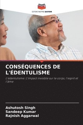 bokomslag Conséquences de l'Édentulisme