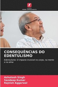 bokomslag Consequncias Do Edentulismo