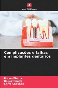 bokomslag Complicações e falhas em implantes dentários