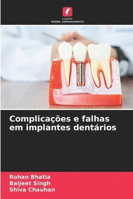 bokomslag Complicaes e falhas em implantes dentrios