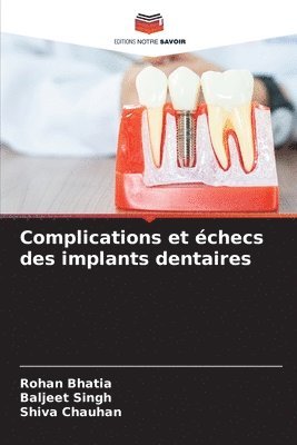 bokomslag Complications et checs des implants dentaires