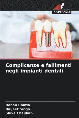 bokomslag Complicanze e fallimenti negli impianti dentali