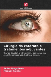 bokomslag Cirurgia da catarata e tratamentos adjuvantes