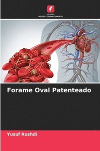 bokomslag Forame Oval Patenteado