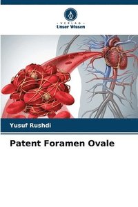 bokomslag Patent Foramen Ovale