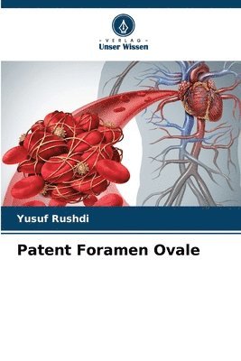 bokomslag Patent Foramen Ovale