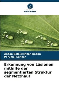 bokomslag Erkennung von Läsionen mithilfe der segmentierten Struktur der Netzhaut