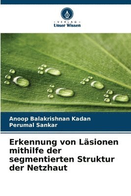 bokomslag Erkennung von Lsionen mithilfe der segmentierten Struktur der Netzhaut