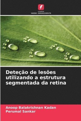 Deteção de lesões utilizando a estrutura segmentada da retina 1