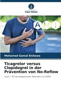 bokomslag Ticagrelor versus Clopidogrel in der Prävention von No-Reflow