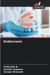 bokomslag Endocrown