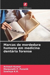 bokomslag Marcas de mordedura humana em medicina dentria forense