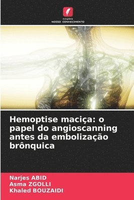 bokomslag Hemoptise macia