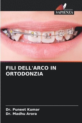 Fili Dell'arco in Ortodonzia 1