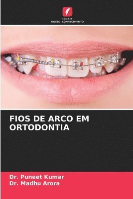 bokomslag Fios de Arco Em Ortodontia