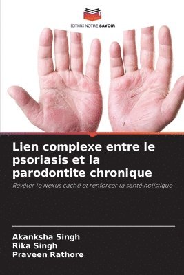 Lien complexe entre le psoriasis et la parodontite chronique 1