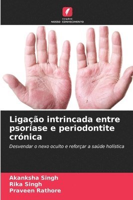 Akanksha Singh, Rika Singh, Praveen Rathore - Ligação intrincada entre psoríase e periodontite crónica, Häftad