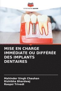 bokomslag Mise En Charge Immdiate Ou Diffre Des Implants Dentaires