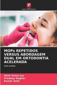 bokomslag MOPs REPETIDOS VERSUS ABORDAGEM DUAL EM ORTODONTIA ACELERADA