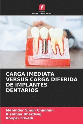 bokomslag Carga Imediata Versus Carga Diferida de Implantes Dentários