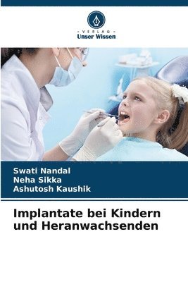 bokomslag Implantate bei Kindern und Heranwachsenden