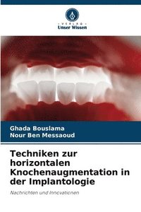 bokomslag Techniken zur horizontalen Knochenaugmentation in der Implantologie