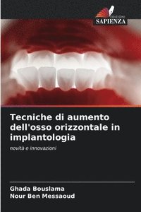 bokomslag Tecniche di aumento dell'osso orizzontale in implantologia