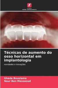 bokomslag Tcnicas de aumento do osso horizontal em implantologia