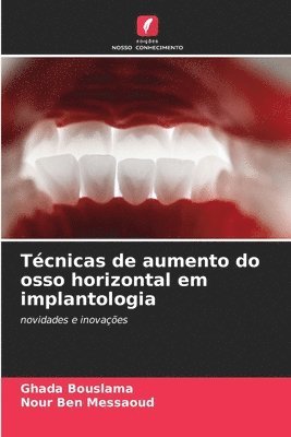 Tcnicas de aumento do osso horizontal em implantologia 1