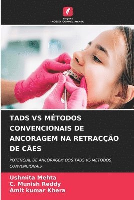 bokomslag Tads Vs Mtodos Convencionais de Ancoragem Na Retraco de Ces