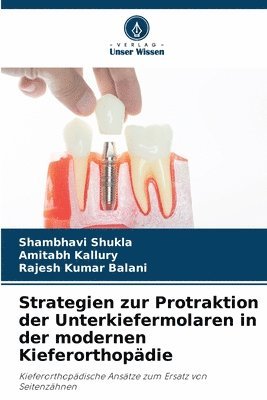 bokomslag Strategien zur Protraktion der Unterkiefermolaren in der modernen Kieferorthopdie