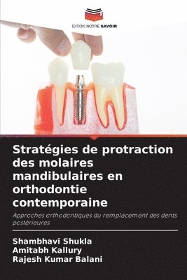 bokomslag Stratégies de protraction des molaires mandibulaires en orthodontie contemporaine