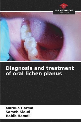 bokomslag Diagnosis and treatment of oral lichen planus