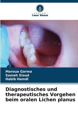 bokomslag Diagnostisches und therapeutisches Vorgehen beim oralen Lichen planus