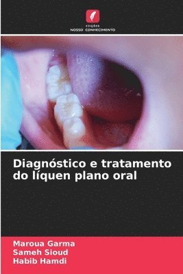 bokomslag Diagnstico e tratamento do lquen plano oral